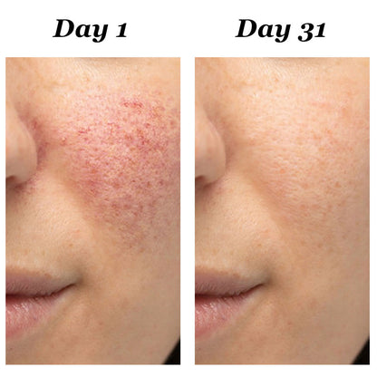 4-in-1 Red Light Therapy Wand