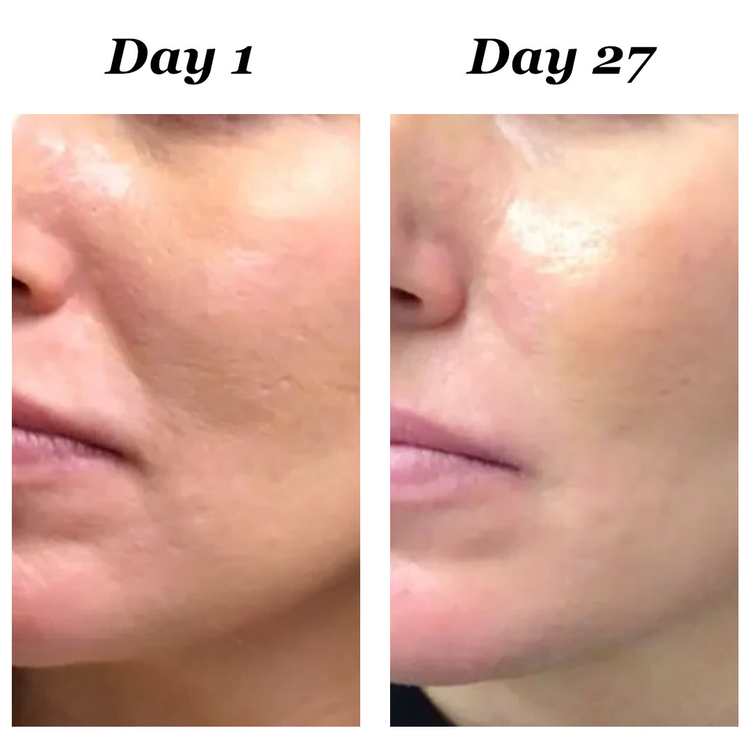 4-in-1 Red Light Therapy Wand
