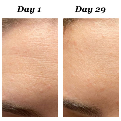 4-in-1 Red Light Therapy Wand